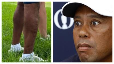 Tiger Woods' leg has been papped without a sleeve on