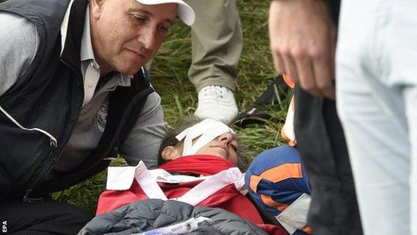 Ryder Cup fan struck in eye by Brooks Koepka says she could have died