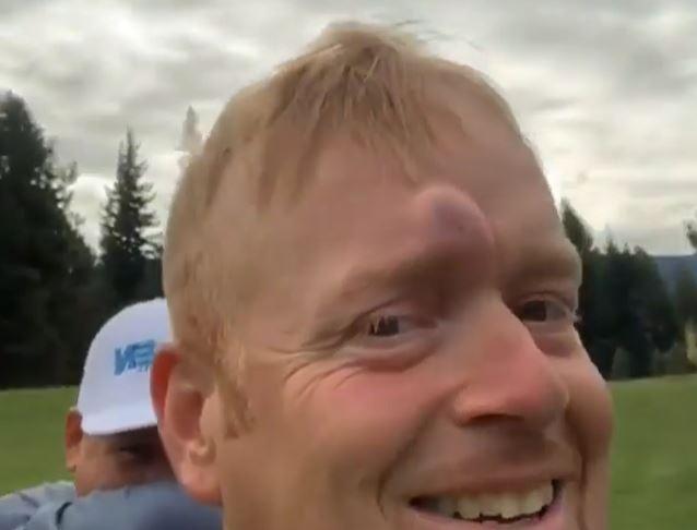 Watch Golfer Gets A Nasty Bump On His Head After Being Hit By A Golf