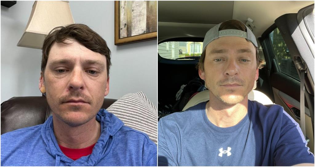 Former PGA Tour player posts haunting image showing effects of drugs ...