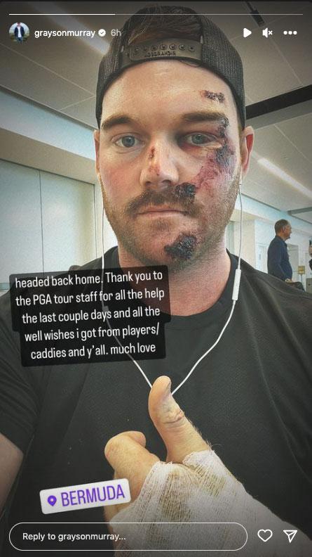 PGA Tour pro shares image of nasty cuts after scooter crash